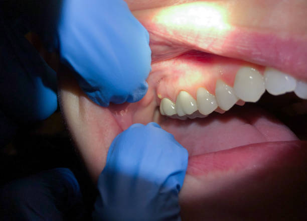 Best Same-Day Emergency Dentist in South Wallins, KY