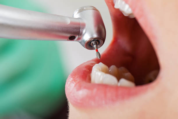 Best After-Hours Emergency Dentist in South Wallins, KY